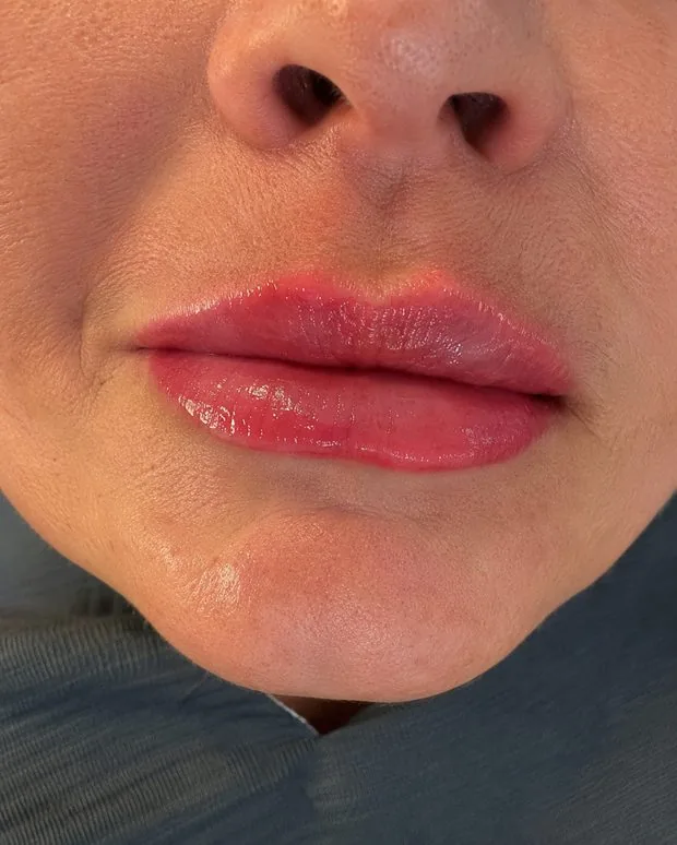 Practitioner performing a precision treatment