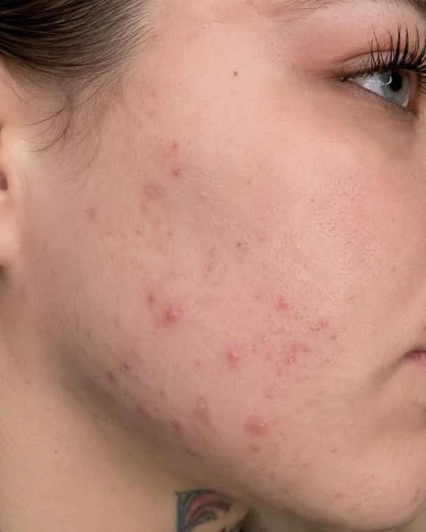 Skin condition assessment close-up
